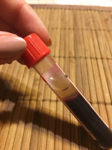 牙刷大比拼，买哪种品牌最靠谱？